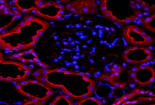 TRP Antibody 이미지