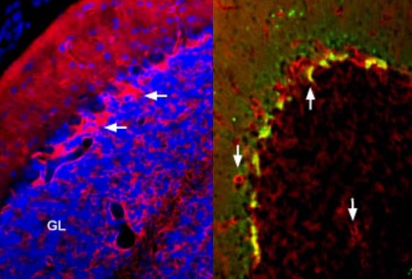 Voltage-Gated K+ Channels | KV Channel Antibody 이미지