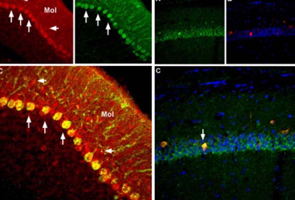 Voltage-Gated Na+ Channels | NaV Channel Antibody 이미지