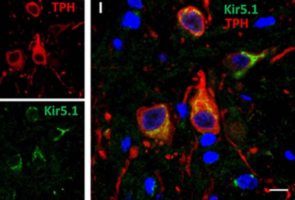 Inward Rectifier K+ Channels | Kir Channels Antibody 이미지