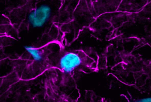 TrueBlack Lipofuscin Autofluorescence Quenchers 이미지