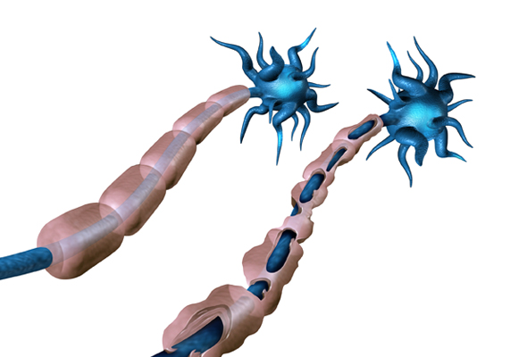 다발성 경화증 연구 | Multiple Sclerosis 항체 이미지