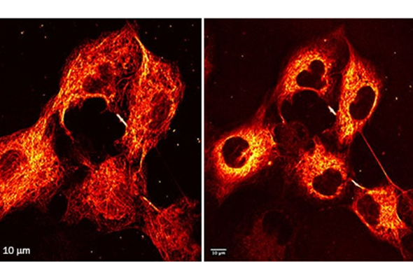 미세소관 형광체 | Microtubule Staining Dye 이미지