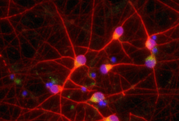 루게릭병 모델 신경세포 | ALS disease model cell 이미지