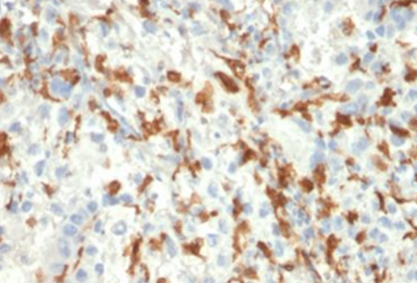 Microglia Marker Antibody 이미지