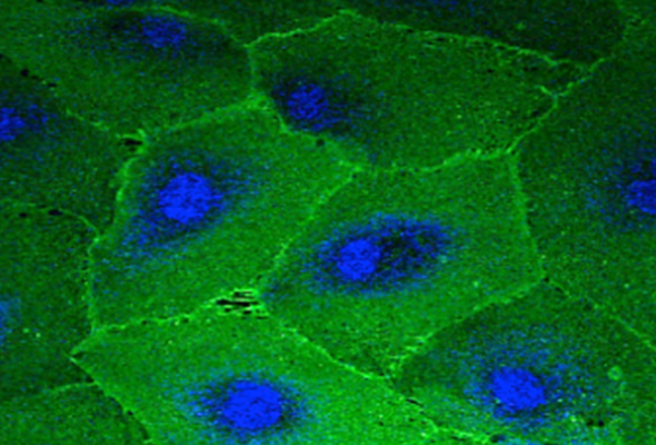 1차 간세포 | Liver Cells | Primary Human Hepatocyte (PHH) 이미지