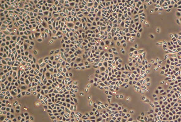 상피세포 배양 | Epithelial Keratinocyte Cell & Media 이미지