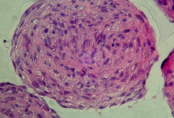 섬유아세포 배양 | Fibroblast Cell & Media 이미지