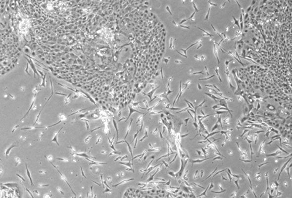 멜라닌세포 배양 | Melanocyte Cell & Media 이미지