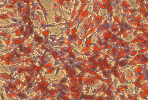 줄기세포, 내피세포 배양 | MSC, IPSC, Endothelial Cell Culture Media 이미지