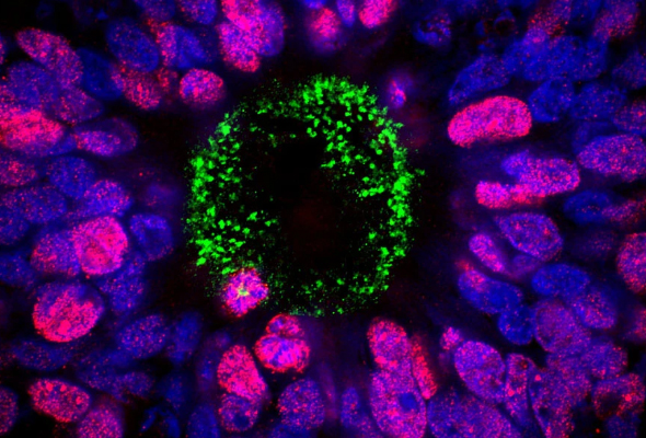 AXOL 신경줄기세포 | Neural Stem Cells & Media 이미지