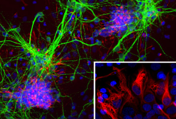 Neuroscience Antibody Panel 이미지