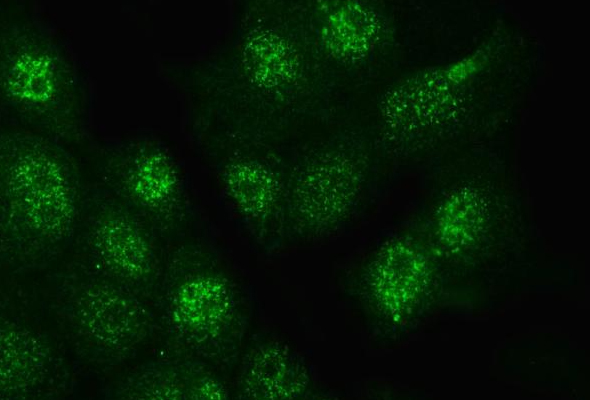 Glycosylation Research Antibody & Protein 이미지