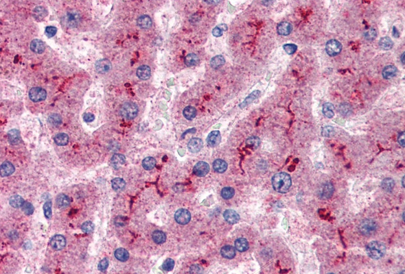 Complement Component Antibody & Protein 이미지