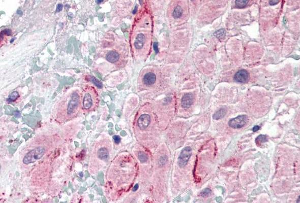 Osteoprotegerin(OPG), Osteopontin(OPN) Antibody & Protein 이미지