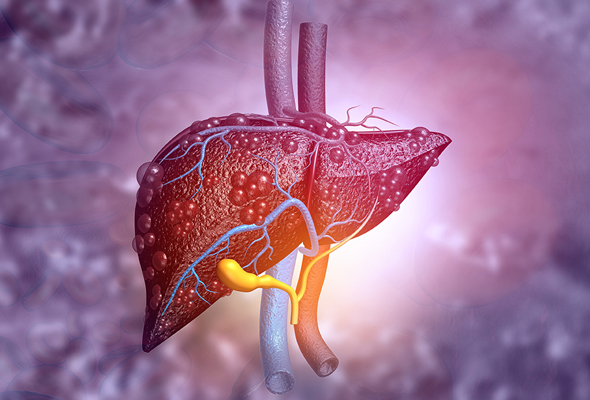 [FAQ] HepaRG를 Steatosis 연구에 사용한 자료가 있나요? 이미지