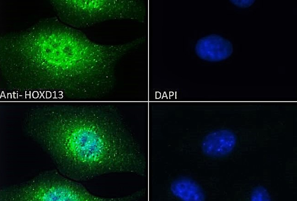 Transcription Factor Antibody 이미지