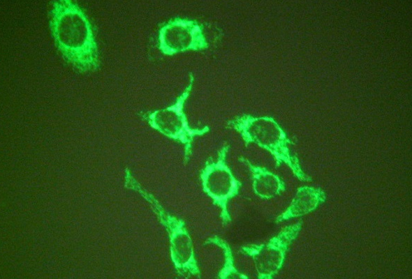 Heat Shock Proteins (HSP) Antibody & Proteins 이미지