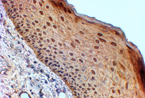 14-3-3 Antibody 이미지