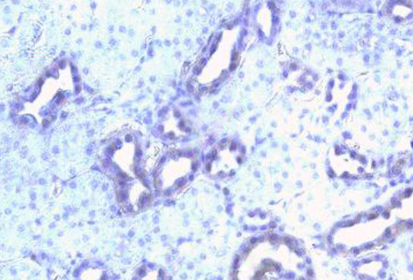 Angiotensin Antibody | Renin Antibody 이미지