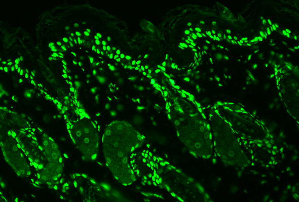 Post-translational modification (PTM) Antibody 이미지