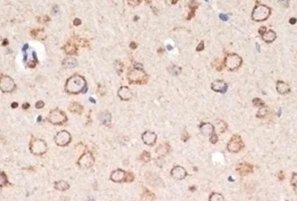 Neuronal marker | dopaminergic neuron, serotonergic neuron, cholinergic neuron 이미지