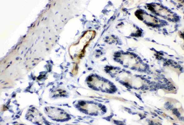 Angiopoietin Antibody & Protein 이미지