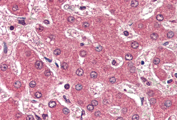 Apolipoprotein Antibody & Protein 이미지