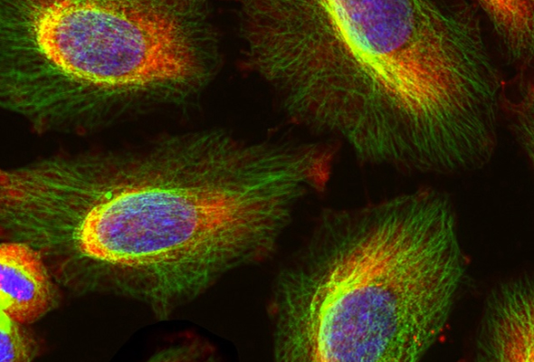 Annexin Antibody & Protein 이미지