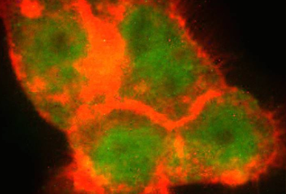 APOBEC Antibody | Gene Mutation 이미지