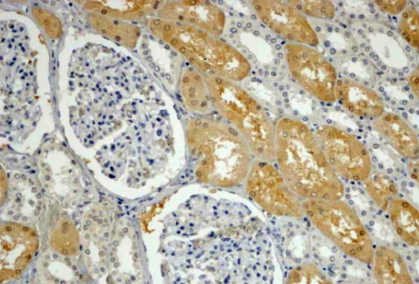 Melanin, melanosome, pigmentation Antibody & Protein 이미지