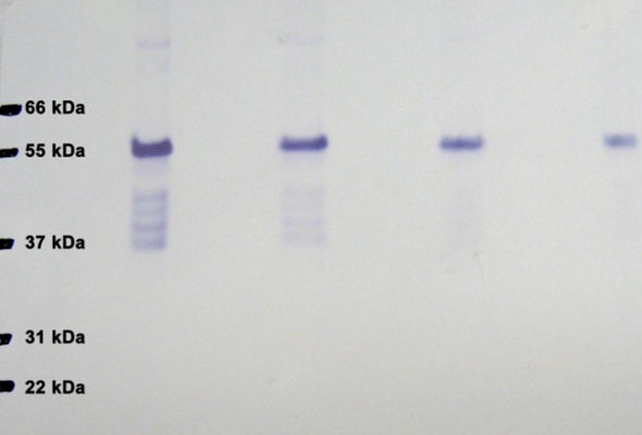 Rho-associated kinase (ROCK) Assay Kits 이미지