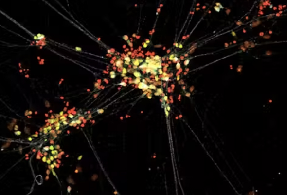 AXOL 운동뉴런 | Motor Neuron Progenitor & Media 이미지