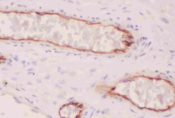 ACE (Angiotensin-converting enzyme)  Antibody & Protein 이미지