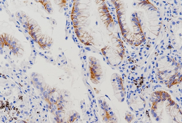 위암 연구 | Claudin 18.2 Antibody 이미지