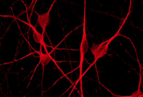 파킨슨 모델 신경세포 | Parkinson's Disease model cell 이미지