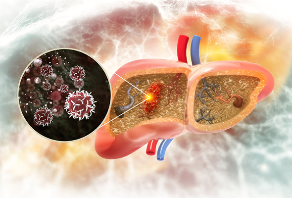 간암 연구 | Liver Cancer Marker Antibody 이미지