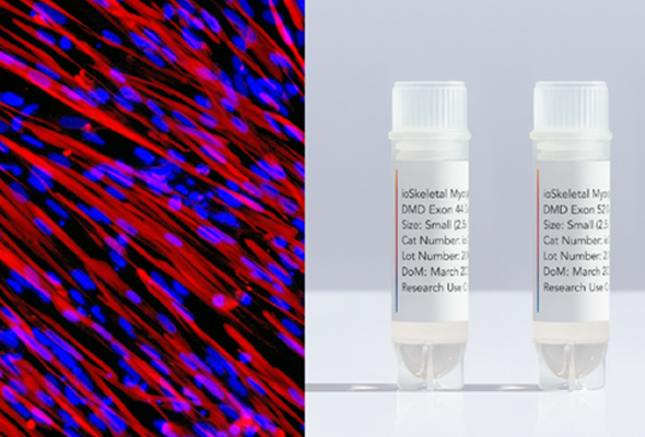 듀센 근이영양증 모델세포 | Duchenne's Muscle Dystrophy model cell 이미지