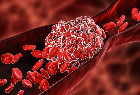 Blood  Coagulation ELISA Kit 이미지