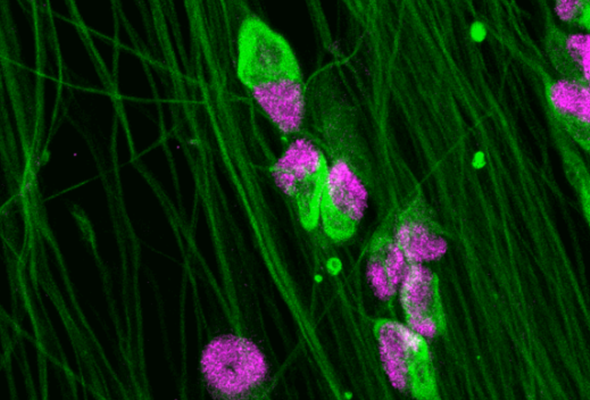 감각뉴런 | ioSensory Neurons | 통증연구 이미지