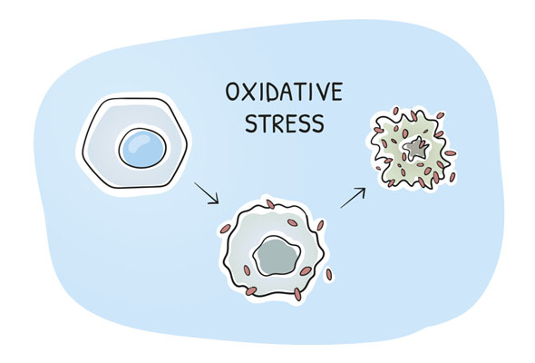 샘플 타입에 따른 Oxidative Stress Assay Kit 선택 가이드 이미지