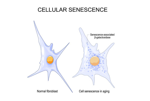 세포 노화 측정 | Cellular Senescence Assays 이미지