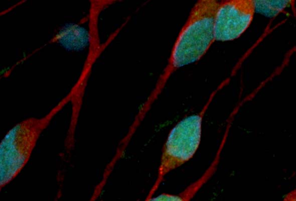 GABA 신경세포 | ioGABAergic Neurons 이미지