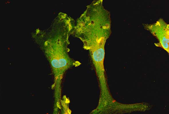 미세교세포 | ioMicroglia Human iPSC-derived microglia 이미지