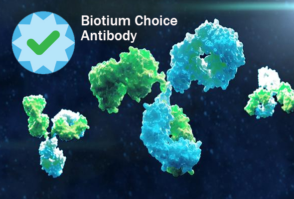 성능이 입증된 Biotium Choice Antibodies 이미지