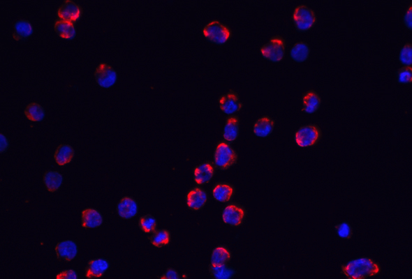 Inflammasome Antibody & Protein 이미지