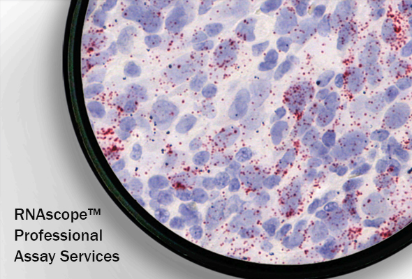 [FAQ] RNAscope In Situ Hybridization (ISH) 분석서비스는 어떤 특징을 갖고 있나요? 이미지