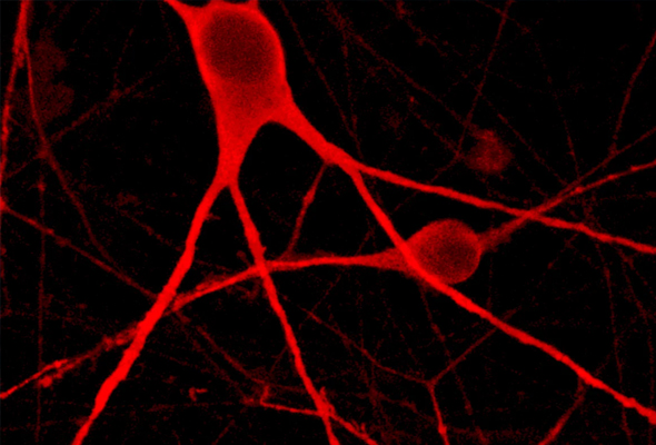 운동뉴런 | ioMotor Neurons 이미지