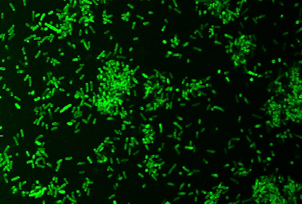 박테리아 내생포자 염색 | BactoSpore™ Bacterial Stains 이미지