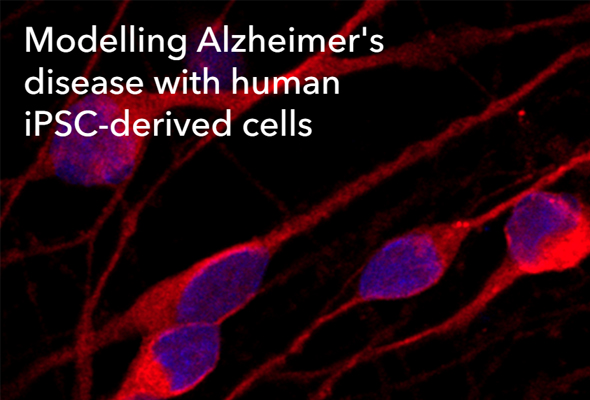 BIT BIO | Alzheimer's disease model 이미지